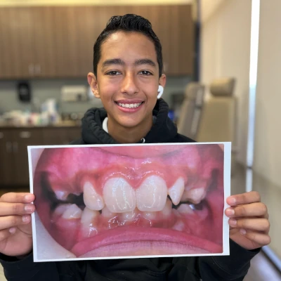 Teenager Holding Braces Before & After 3